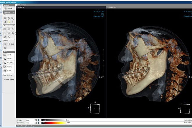 Cybermed OnDemand3D